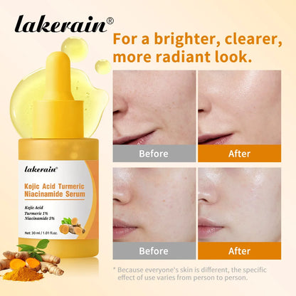 Kojic Acid Turmeric Niacinamide Serum Precise Dropper Design Deep Moisturizing Soothe Skin Brighten Skin Tone Facial Care